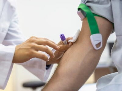 From Lab to Life-Saver: CSIR-NIIST's Simple Blood Test for Cancer and Alzheimer’s