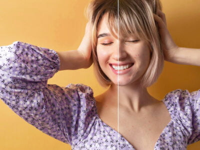 Protecting Your Skin Barrier: Tips for a Stronger, Healthier Epidermis